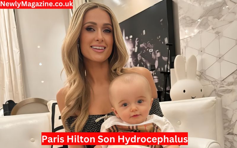 Paris Hilton Son Hydrocephalus